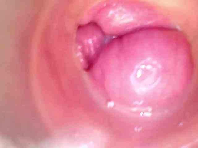 Shannon-kane Shannon-kane