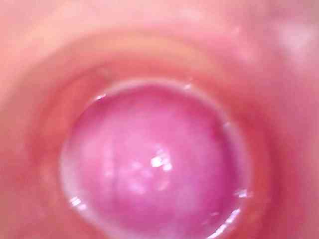 Shannon-kane Shannon-kane