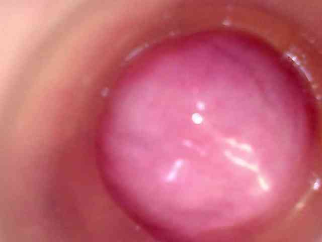 Shannon-kane Shannon-kane