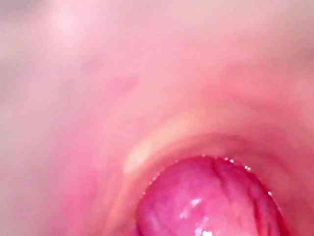 Shannon-kane Shannon-kane