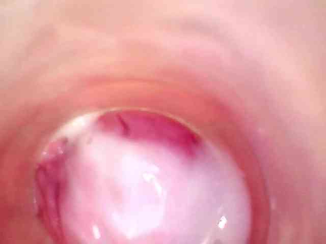 Shannon-kane Shannon-kane