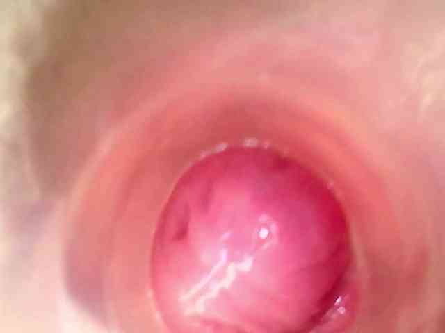 Shannon-kane Shannon-kane