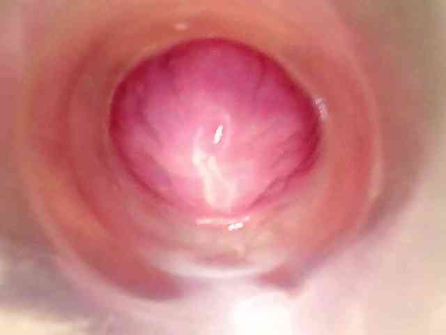 Shannon-kane Shannon-kane