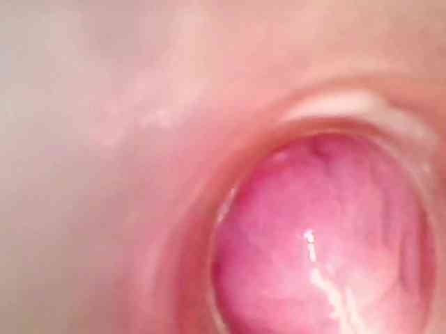 Shannon-kane Shannon-kane