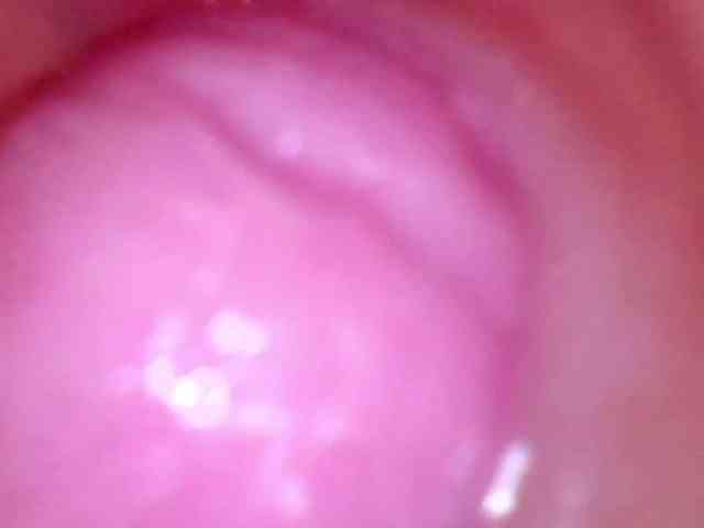 Shannon-kane Shannon-kane