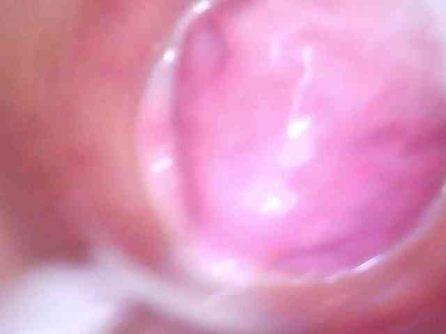 Shannon-kane Shannon-kane