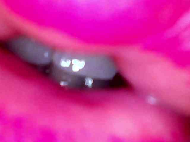 Shannon-kane Shannon-kane