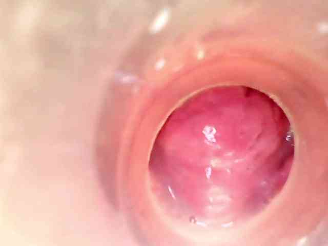 Shannon-kane Shannon-kane