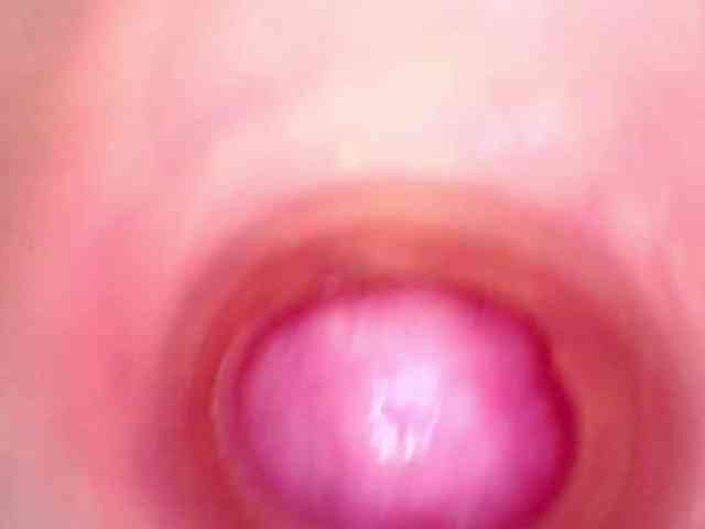 Shannon-kane Shannon-kane