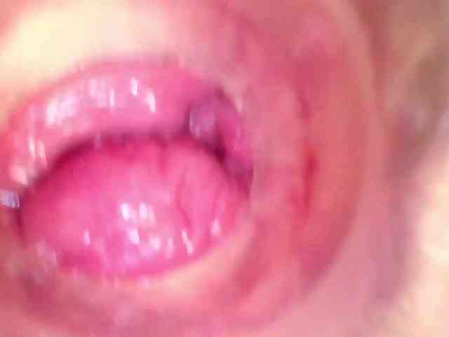 Shannon-kane Shannon-kane