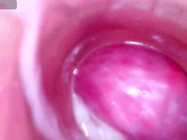 Shannon-kane Shannon-kane