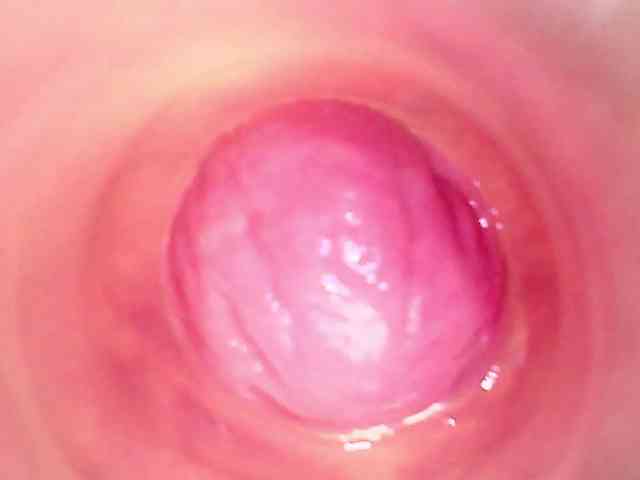 Shannon-kane Shannon-kane