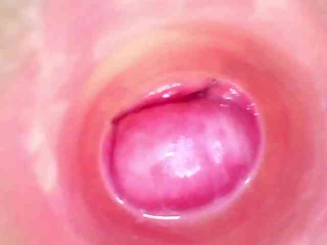 Shannon-kane Shannon-kane