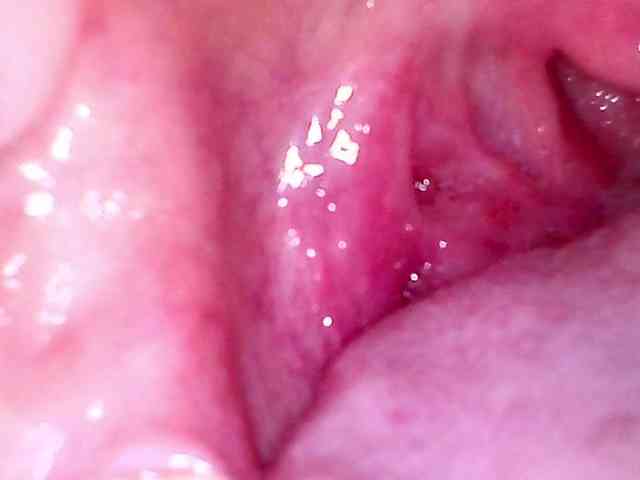 Shannon-kane Shannon-kane