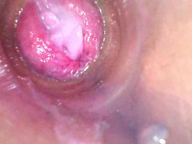 Shannon-kane Shannon-kane