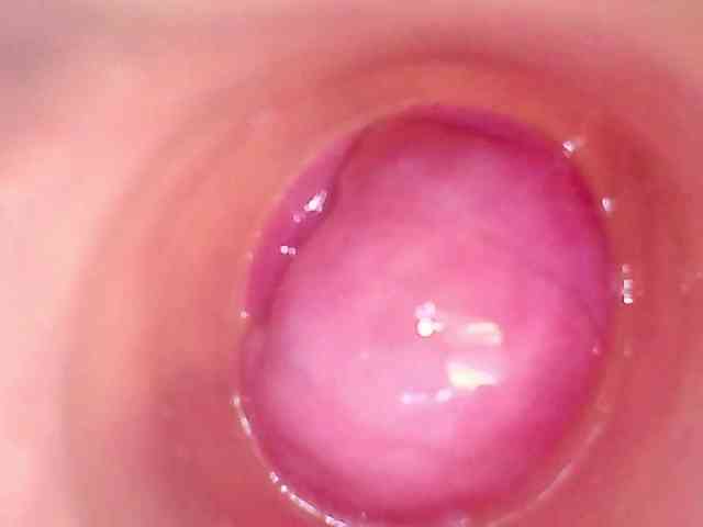 Shannon-kane Shannon-kane