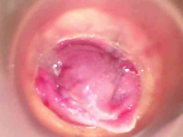 Shannon-kane Shannon-kane