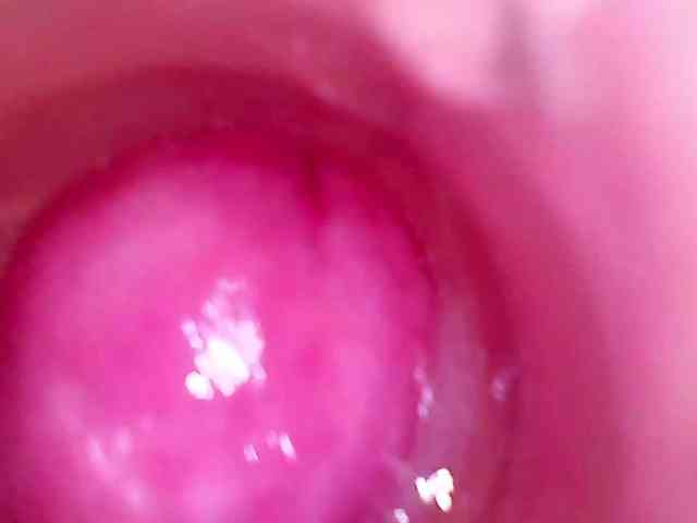 Shannon-kane Shannon-kane