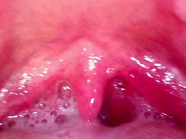 Shannon-kane Shannon-kane