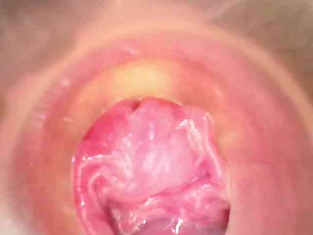 Shannon-kane Shannon-kane