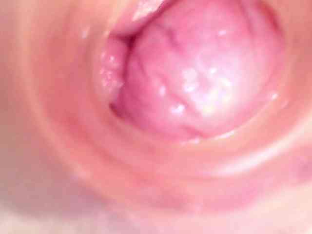 Shannon-kane Shannon-kane