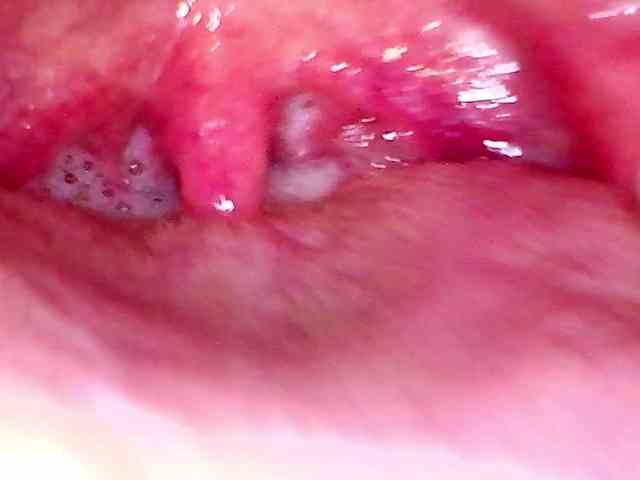 Shannon-kane Shannon-kane