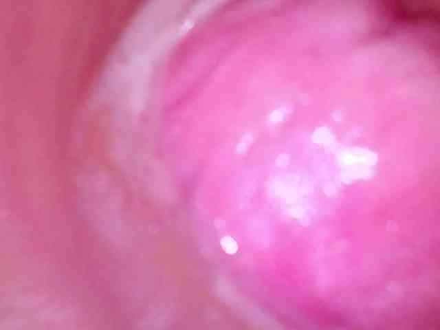 Shannon-kane Shannon-kane