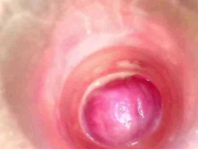 Shannon-kane Shannon-kane