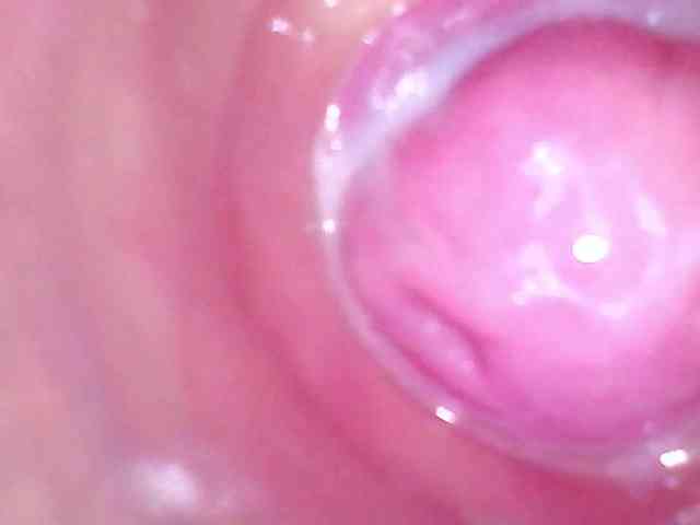 Shannon-kane Shannon-kane