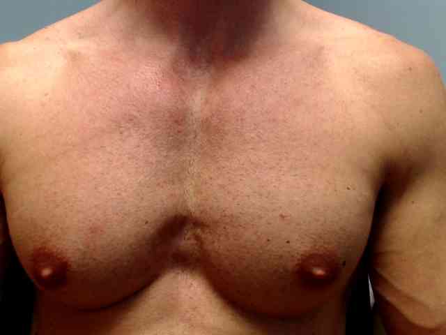 flexhard1