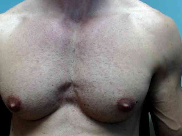 flexhard1