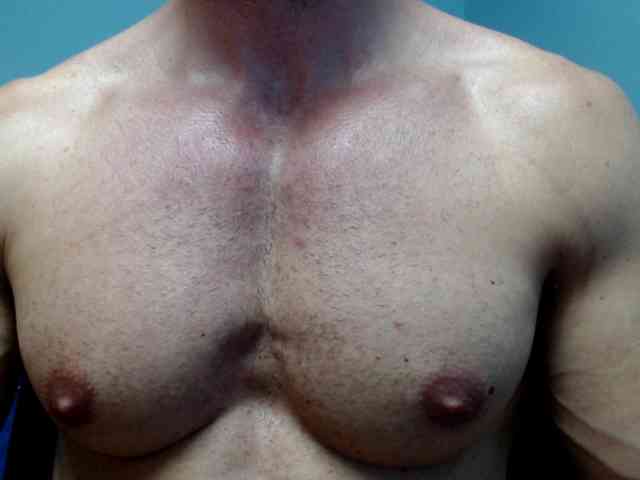 flexhard1