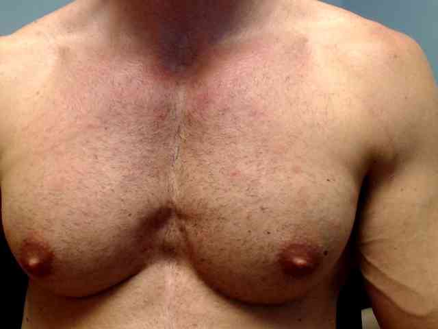 flexhard1