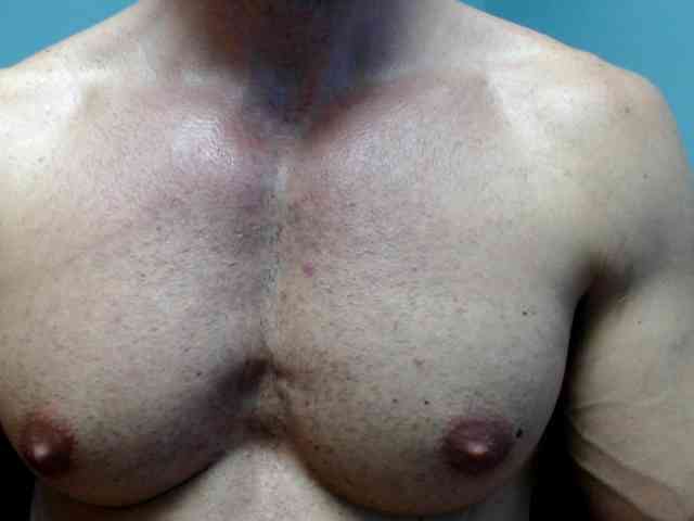 flexhard1
