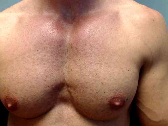 flexhard1