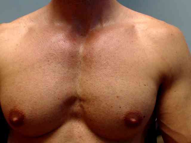 flexhard1