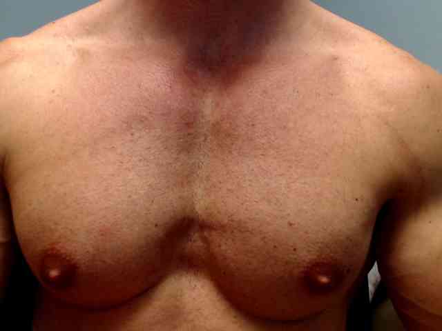 flexhard1