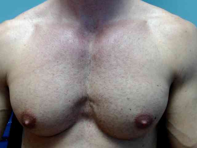 flexhard1