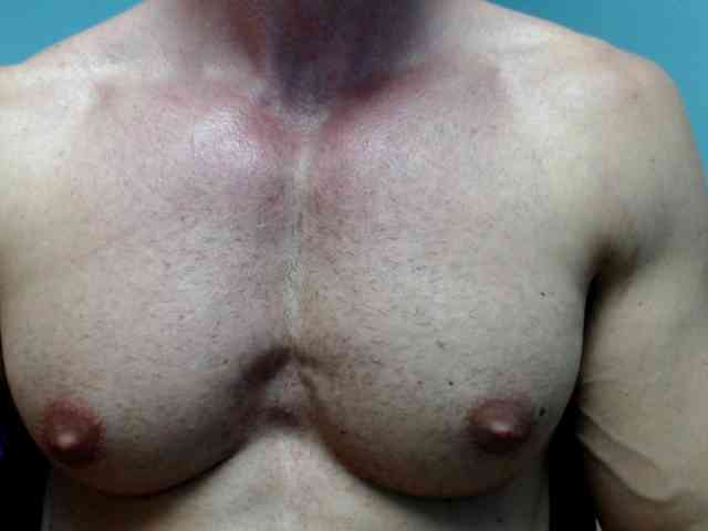 flexhard1