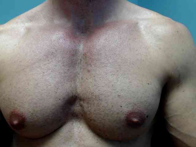 flexhard1