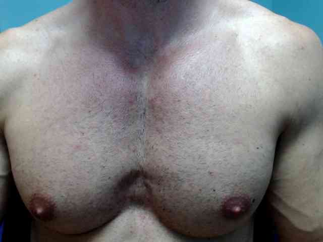 flexhard1