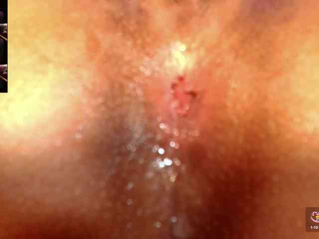 Thalia-skizy webcam