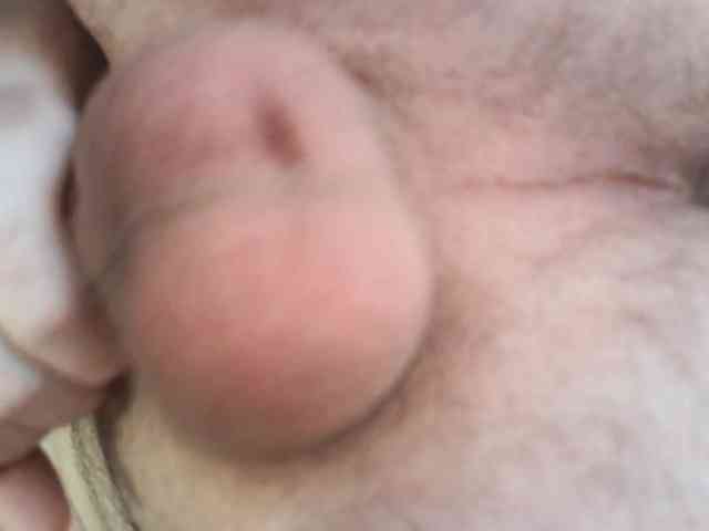 -Rufl-