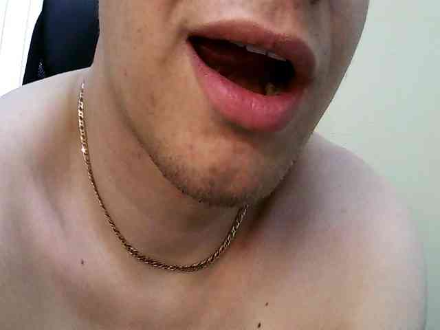 LEPOoloLEPO1