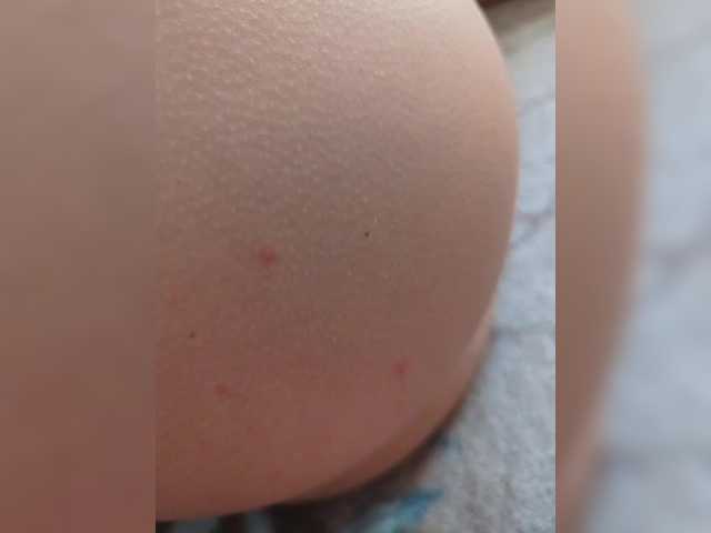 Preview of anallovess