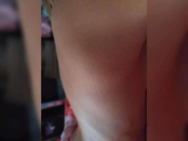 Anallovess