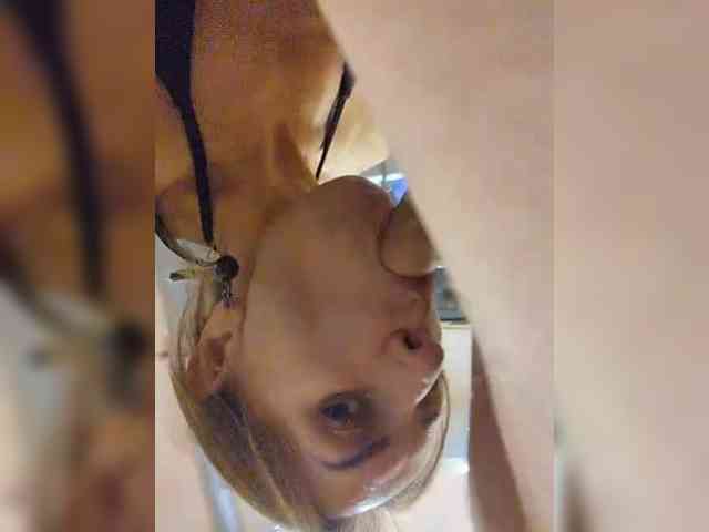 Anallovess