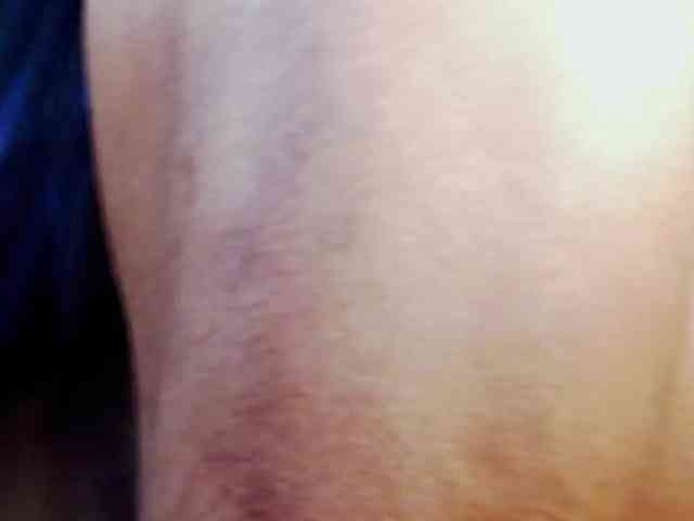 Blackstar011 Blackstar011