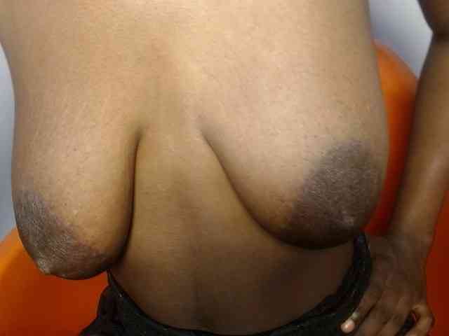 Mandymia