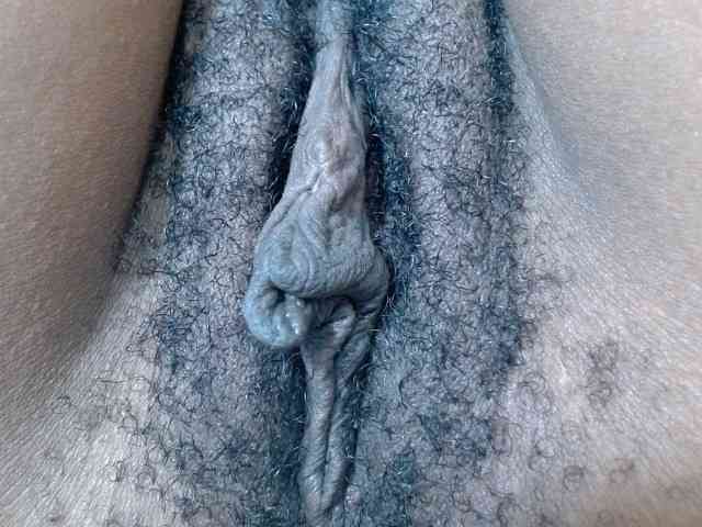 Skinybitchx Skinybitchx